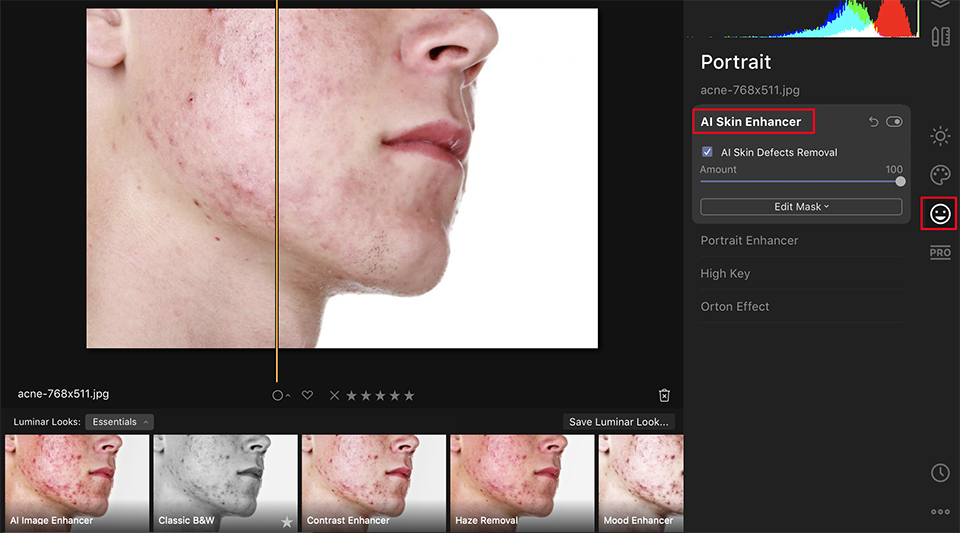 Ai skin enhancer acne